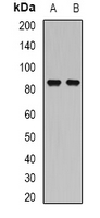 FACT / SSRP1 Antibody - Western blot analysis of SSRP1 expression in SW620 (A); HeLa (B) whole cell lysates.