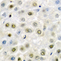 FACT / SSRP1 Antibody - Immunohistochemical analysis of SSRP1 staining in mouse liver formalin fixed paraffin embedded tissue section. The section was pre-treated using heat mediated antigen retrieval with sodium citrate buffer (pH 6.0). The section was then incubated with the antibody at room temperature and detected using an HRP conjugated compact polymer system. DAB was used as the chromogen. The section was then counterstained with hematoxylin and mounted with DPX.