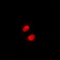 FACT / SSRP1 Antibody - Immunofluorescent analysis of SSRP1 staining in HeLa cells. Formalin-fixed cells were permeabilized with 0.1% Triton X-100 in TBS for 5-10 minutes and blocked with 3% BSA-PBS for 30 minutes at room temperature. Cells were probed with the primary antibody in 3% BSA-PBS and incubated overnight at 4 deg C in a humidified chamber. Cells were washed with PBST and incubated with a DyLight 594-conjugated secondary antibody (red) in PBS at room temperature in the dark.