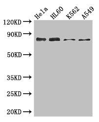 FACT / SSRP1 Antibody - Western Blot Positive WB detected in:Hela whole cell lysate,HL60 whole cell lysate,K562 whole cell lysate,A549 whole cell lysate All Lanes: SSRP1 antibody at 3.4ug/ml Secondary Goat polyclonal to rabbit IgG at 1/50000 dilution Predicted band size: 82 kDa Observed band size: 82 kDa