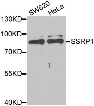 FACT / SSRP1 Antibody - Western blot analysis of extracts of various cell lines, using SSRP1 antibody at 1:1000 dilution. The secondary antibody used was an HRP Goat Anti-Rabbit IgG (H+L) at 1:10000 dilution. Lysates were loaded 25ug per lane and 3% nonfat dry milk in TBST was used for blocking. An ECL Kit was used for detection and the exposure time was 90s.
