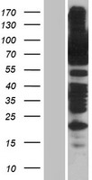 FACT / SSRP1 Protein - Western validation with an anti-DDK antibody * L: Control HEK293 lysate R: Over-expression lysate