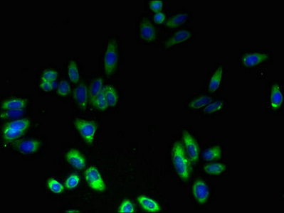 FAD104 / FNDC3B Antibody - Immunofluorescent analysis of HepG2 cells using FNDC3B Antibody at dilution of 1:100 and Alexa Fluor 488-congugated AffiniPure Goat Anti-Rabbit IgG(H+L)