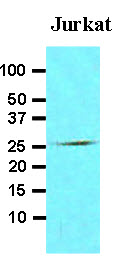 FADD Antibody - Cell lysates of Jurkat (30 ug) were resolved by SDS-PAGE, transferred to NC membrane and probed with anti-human FADD (1:500). Proteins were visualized using a goat anti-mouse secondary antibody conjugated to HRP and an ECL detection system.