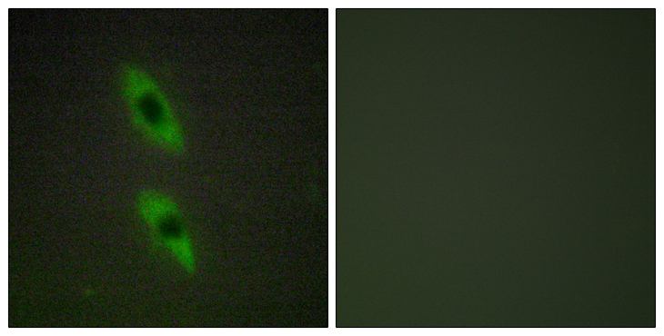 FADD Antibody - Immunofluorescence analysis of HUVEC cells, using FADD Antibody. The picture on the right is blocked with the synthesized peptide.