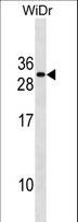 FADD Antibody - FADD Antibody western blot of WiDr cell line lysates (35 ug/lane). The FADD antibody detected the FADD protein (arrow).