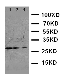 FADD Antibody - WB of FADD antibody. Lane 1: HELA Cell Lysate. Lane 2: SMMC Cell Lysate. Lane 3: SW620 Cell Lysate.