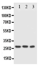 FADD Antibody - Anti-FADD antibody, Western blotting Lane 1: HELA Cell LysateLane 2: SMMC Cell LysateLane 3: SW620 Cell Lysate