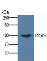FADD Antibody - Western Blot; Sample: Human Serum.