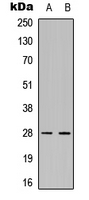 FADD Antibody - Western blot analysis of FADD expression in A549 (A); HeLa (B) whole cell lysates.