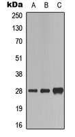 FADD Antibody - Western blot analysis of FADD (pS194) expression in Jurkat (A); mouse kidney (B); mouse brain (C) whole cell lysates.