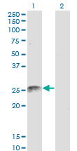 FADD Antibody - Western blot of FADD expression in transfected 293T cell line by FADD monoclonal antibody (M02), clone 3C3.