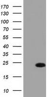 FADD Antibody - HEK293T cells were transfected with the pCMV6-ENTRY control (Left lane) or pCMV6-ENTRY FADD (Right lane) cDNA for 48 hrs and lysed. Equivalent amounts of cell lysates (5 ug per lane) were separated by SDS-PAGE and immunoblotted with anti-FADD.