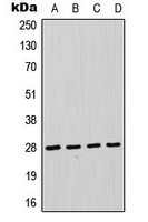 FADD Antibody - Western blot analysis of FADD expression in HeLa (A); Jurkat (B); THP1 (C); A431 (D) whole cell lysates.