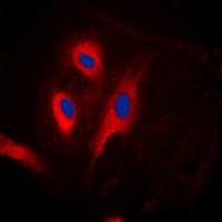 FADD Antibody - Immunofluorescent analysis of FADD staining in HeLa cells. Formalin-fixed cells were permeabilized with 0.1% Triton X-100 in TBS for 5-10 minutes and blocked with 3% BSA-PBS for 30 minutes at room temperature. Cells were probed with the primary antibody in 3% BSA-PBS and incubated overnight at 4 C in a humidified chamber. Cells were washed with PBST and incubated with a DyLight 594-conjugated secondary antibody (red) in PBS at room temperature in the dark. DAPI was used to stain the cell nuclei (blue).