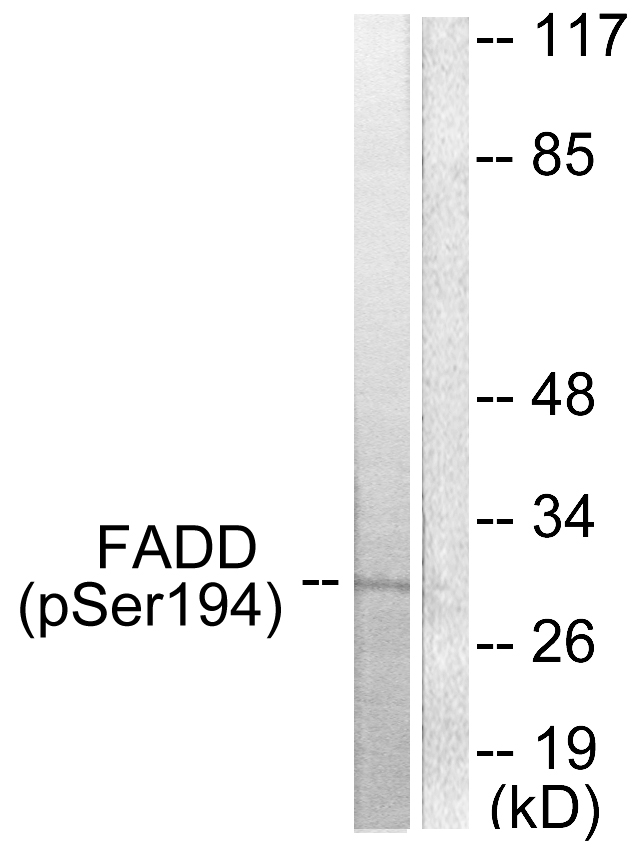 FADD Antibody - Western blot analysis of lysates from HeLa cells treated with Paclitaxel 1uM 60', using FADD (Phospho-Ser194) Antibody. The lane on the right is blocked with the phospho peptide.