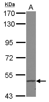 FADS1 Antibody - Sample (30 ug of whole cell lysate) A: A549 7.5% SDS PAGE FADS1 antibody diluted at 1:1000