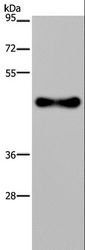 FADS1 Antibody - Western blot analysis of Human fetal brain tissue, using FADS1 Polyclonal Antibody at dilution of 1:300.