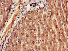 FADS1 Antibody - Immunohistochemistry of paraffin-embedded human liver tissue using FADS1 Antibody at dilution of 1:100