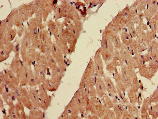 FADS1 Antibody - Immunohistochemistry of paraffin-embedded human heart tissue using FADS1 Antibody at dilution of 1:100