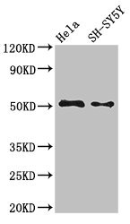 FADS1 Antibody - Western Blot Positive WB detected in: Hela whole cell lysate, SH-SY5Y whole cell lysate All lanes: FADS1 antibody at 3.4µg/ml Secondary Goat polyclonal to rabbit IgG at 1/50000 dilution Predicted band size: 52, 43 kDa Observed band size: 52 kDa