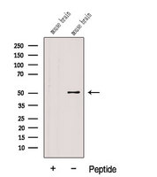 FADS1 Antibody - Western blot analysis of extracts of HeLa cells using FADS1 antibody. The lane on the left was treated with blocking peptide.