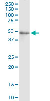 FADS3 Antibody - FADS3 monoclonal antibody (M07), clone 3D2. Western Blot analysis of FADS3 expression in human placenta.