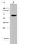 FADS3 Antibody - Anti-FADS3 rabbit polyclonal antibody at 1:500 dilution. Lane A: Rat kidney tissue lysate. Lysates/proteins at 30 ug per lane. Secondary: Goat Anti-Rabbit IgG (H+L)/HRP at 1/10000 dilution. Developed using the ECL technique. Performed under reducing conditions. Predicted band size: 51 kDa. Observed band size: 51 kDa.