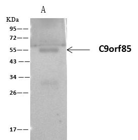 FADS3 Antibody - C9orf85 was immunoprecipitated using: Lane A: 0.5 mg Rat kidney Whole Cell Lysate. 4 uL anti-C9orf85 rabbit polyclonal antibody and 60 ug of Immunomagnetic beads Protein A/G. Primary antibody: Anti-C9orf85 rabbit polyclonal antibody, at 1:100 dilution. Secondary antibody: Clean-Blot IP Detection Reagent (HRP) at 1:1000 dilution. Developed using the ECL technique. Performed under reducing conditions. Predicted band size: 51 kDa. Observed band size: 54 kDa.