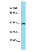 FADS6 Antibody - FADS6 antibody Western Blot of Fetal Liver. Antibody dilution: 1 ug/ml.  This image was taken for the unconjugated form of this product. Other forms have not been tested.