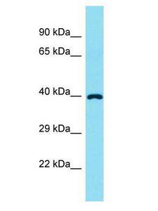 FADS6 Antibody - FADS6 antibody Western Blot of Fetal Liver. Antibody dilution: 1 ug/ml.  This image was taken for the unconjugated form of this product. Other forms have not been tested.