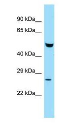 FAF2 / ETEA Antibody - FAF2 / ETEA antibody Western Blot of Mouse Liver.  This image was taken for the unconjugated form of this product. Other forms have not been tested.