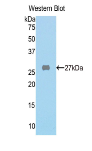 FAH Antibody - Western blot of recombinant FAH.  This image was taken for the unconjugated form of this product. Other forms have not been tested.