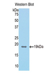 FAH Antibody - Western blot of recombinant FAH.  This image was taken for the unconjugated form of this product. Other forms have not been tested.