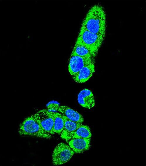 FAH Antibody - Confocal immunofluorescence of FAH Antibody with HepG2 cell followed by Alexa Fluor 488-conjugated goat anti-rabbit lgG (green). DAPI was used to stain the cell nuclear (blue).