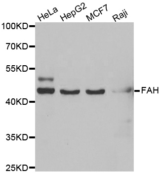 FAH Antibody - Western blot analysis of extracts of various cell lines.