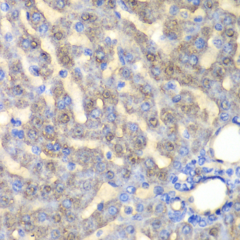 FAH Antibody - Immunohistochemistry of paraffin-embedded rat liver tissue.