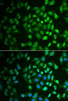 FAH Antibody - Immunofluorescence analysis of A549 cells.