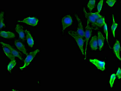 FAH Antibody - Immunofluorescent analysis of Hela cells using FAH Antibody at dilution of 1:100 and Alexa Fluor 488-congugated AffiniPure Goat Anti-Rabbit IgG(H+L)