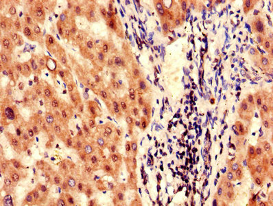 FAH Antibody - Immunohistochemistry of paraffin-embedded human liver tissue using FAH Antibody at dilution of 1:100