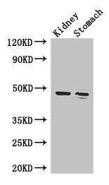 FAH Antibody - Western Blot Positive WB detected in: Mouse kidney tissue, Mouse stomach tissue All lanes: FAH antibody at 3.4µg/ml Secondary Goat polyclonal to rabbit IgG at 1/50000 dilution Predicted band size: 47, 39 kDa Observed band size: 47 kDa