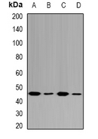 FAH Antibody - Western blot analysis of Fumarylacetoacetase expression in HepG2 (A); MCF7 (B); mouse liver (C); rat kidney (D) whole cell lysates.