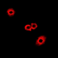 FAH Antibody - Immunofluorescent analysis of Fumarylacetoacetase staining in A549 cells. Formalin-fixed cells were permeabilized with 0.1% Triton X-100 in TBS for 5-10 minutes and blocked with 3% BSA-PBS for 30 minutes at room temperature. Cells were probed with the primary antibody in 3% BSA-PBS and incubated overnight at 4 deg C in a humidified chamber. Cells were washed with PBST and incubated with a DyLight 594-conjugated secondary antibody (red) in PBS at room temperature in the dark.