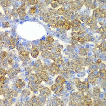 FAH Antibody - Immunohistochemistry of paraffin-embedded mouse liver using FAH antibody at dilution of 1:100 (40x lens).