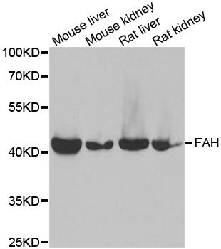 FAH Antibody - Western blot analysis of extracts of various cell lines, using FAH antibody at 1:1000 dilution. The secondary antibody used was an HRP Goat Anti-Rabbit IgG (H+L) at 1:10000 dilution. Lysates were loaded 25ug per lane and 3% nonfat dry milk in TBST was used for blocking. An ECL Kit was used for detection and the exposure time was 5s.