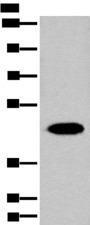 FAH Antibody - Western blot analysis of Human liver tissue lysate  using FAH Polyclonal Antibody at dilution of 1:700