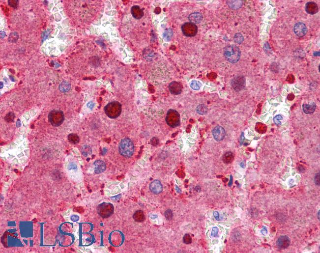 FAH Antibody - Anti-FAH antibody IHC of human liver. Immunohistochemistry of formalin-fixed, paraffin-embedded tissue after heat-induced antigen retrieval. Antibody concentration 5 ug/ml.  This image was taken for the unconjugated form of this product. Other forms have not been tested.