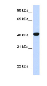 FAH Antibody - FAH antibody Western blot of Fetal Liver lysate. This image was taken for the unconjugated form of this product. Other forms have not been tested.