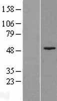 FAH Protein - Western validation with an anti-DDK antibody * L: Control HEK293 lysate R: Over-expression lysate