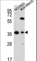 FAHD2A Antibody - FAHD2A Antibody western blot of NCI-H292,MDA-MB435 cell line lysates (35 ug/lane). The FAHD2A antibody detected the FAHD2A protein (arrow).
